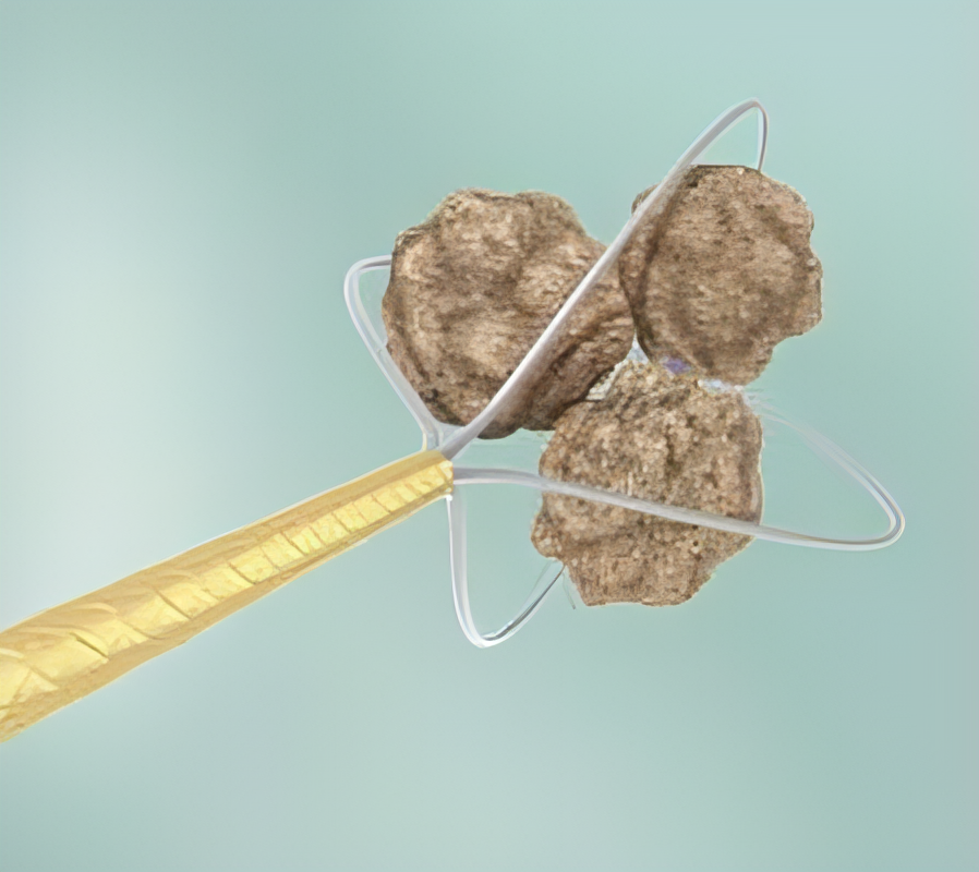 SkyLite Canastilla Sin Punta de Nitinol