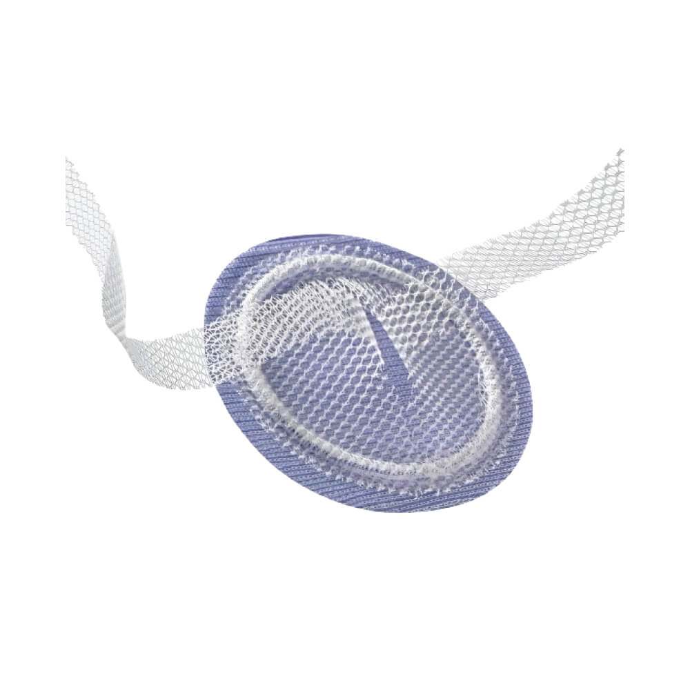 Ventralex ST Malla Hernia Umbilical o Trocar